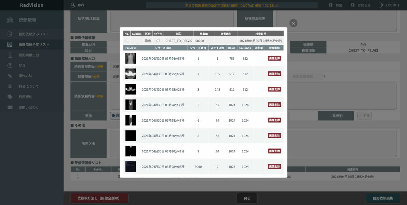 遠隔読影システム RadVision画面